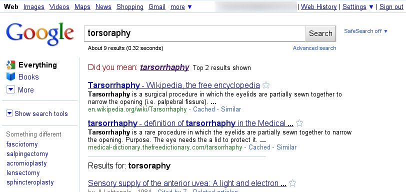Torsoraphy par Google